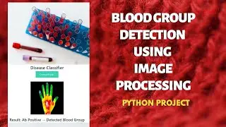 Blood Grouping Detection Using Image Processing | IEEE Machine Learning Projects