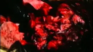 Dead White Males - Earth Waste (Official Bootleg Video)