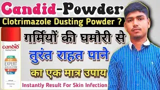 कैंडिड पाउडर के अनेकों फायदे का इस्तेमाल जाने।। तुरन्त राहत पाने के लिए