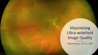 Maximizing Ultra-widefield Image Quality