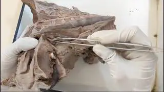 Oropharynx