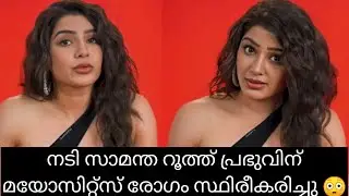 നടി സാമന്തയുടെ രോഗം കേട്ട് അമ്പരന്ന് ആരാധകർ 😵‍💫 രോഗം വെളുപ്പെടുത്തി സാമന്ത 😪#live#samantharuthprabhu