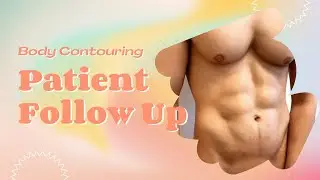 Body Contouring | Patient Follow Up | West Hollywood, CA | Dr. Jason Emer