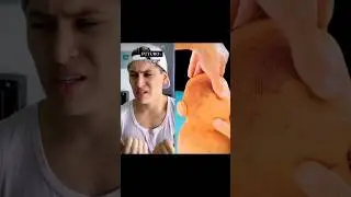 #Pov