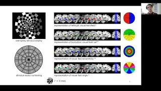 OHBM 2022 – Poster 