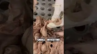 Small Intestine  #16 | Anatomy Abdomen and Pelvis | #mbbs #neet #viral #shorts #shortfeed