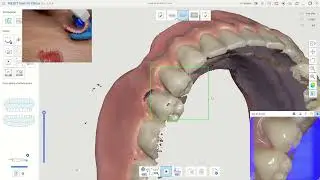 Exocad 3.2 Elefsina - Duplicata de prothèse de A à Z