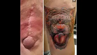 Tattoos Covering Scars!