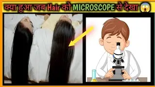 Jab बालों को Microscope से देखा फिर जो हुआ?। What Happened When See The Hairs By Microscope #shorts