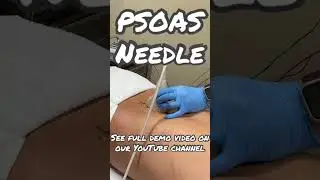#psoas