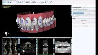 BSP V4.13: Automatic Button / Attachments Placement