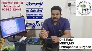 osteoarthritis knee|xray changes| Telugu|మోకాలు xray లో గాప్| Dr Raju|Orthopedic Hospital Mancherial