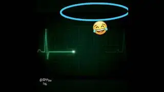 men will never skip ass 😂 even when they are on the edge of death
