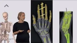 Skjelett: Overekstremiteten - del 2