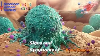 American Cancer Society | Spotlighting Silent Signals: 20 Overlooked Cancer Symptoms in Men & Women