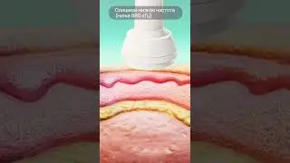 Методика фонофореза Гидрокортизона c Физиофон (часть 3) 