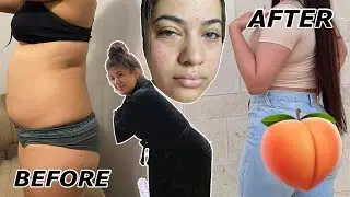 I GOT A BBL!!! THIS IS WHAT HAPPENED... SURGERY EXPERIENCE