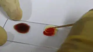 Blood Grouping Experiment - Amrita University