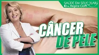CÂNCER DE PELE I SAÚDE EM SEU LAR