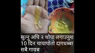 मात्र २ थोपा सुत्नुअघी लगाउनुस 10 दिनमा तपाइको अनुहार सोचेजस्तै हुनेछ apply just 2 drops at night