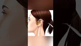 ASMR WORM ATTACKED 