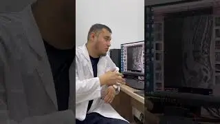 Center Dr.Gafuroff | umurtqa grija Aperatsiya haqida  malumotlar. 331578811