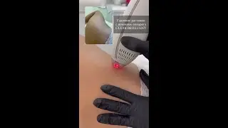 КАК ИЗБАВИТЬСЯ ОТ РАСТЯЖЕК НА ТЕЛЕ? 🔥