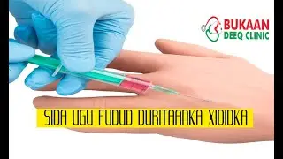 Sidee u durikartaa xididka | qaab duritaanka gacanta