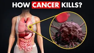 What Happens In Cancer? | Symptoms, Causes And Types Of Cancer