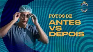 Fotos de antes e depois