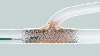 Glider™ PTCA Balloon Catheter