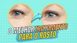 TOXINA BOTULÍNICA