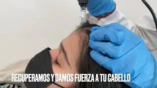 Mesoterapia Capilar Femenina. Clínica Merced 👩‍⚕️👨‍⚕️