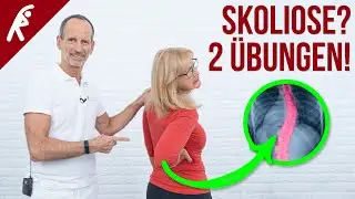 Probiere DIESE 2 Skoliose Übungen gegen deinen krummen Rücken!