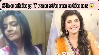 Pakistani Actresses Before & After Plastic Surgery 😱 | Shocking Transformations