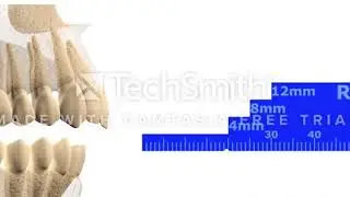 Bite Registration Airway Metrics Video