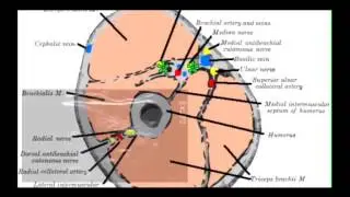 How To: IV Insertion For Everyone!