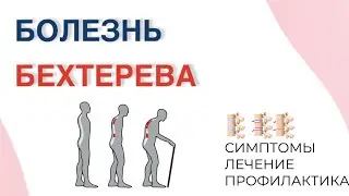 БОЛЕЗНЬ БЕХТЕРЕВА. СИМПТОМЫ, ЛЕЧЕНИЕ И ПРОФИЛАКТИКА