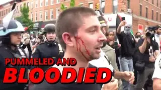 NYPD BLOODIES & PUMMELS Pro-Palestinian Protesters