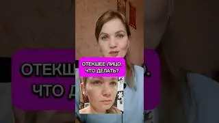 Отеки, дряблая кожа лица. что делат? #лицо #кожа #отёки #сахар #марафон #reels