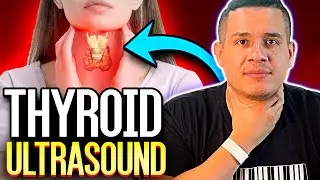 Thyroid Ultrasound | My Experience