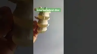 #Intervertebral