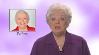 Hair Loss Solutions; ReAllusions Client, Nancy