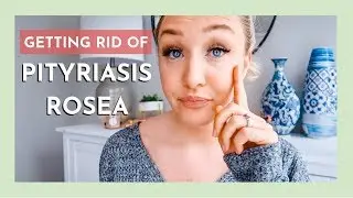 PITYRIASIS ROSEA | HOW I GOT RID OF IT FAST | Laura-Lee