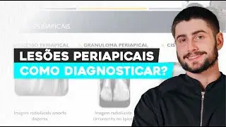 Lesões periapicais: Como diagnosticar?