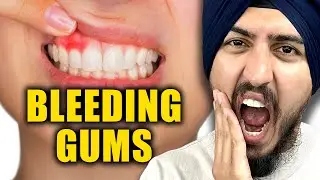 The #1 Cause of Bleeding Gums