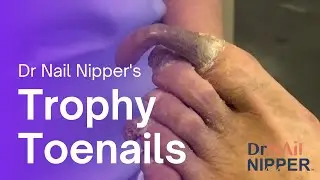 Trophy Toenails.  FEET-ure Friday (2022)