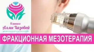 Фракционная мезотерапия. Как избавиться от растяжек после родов. Удаление рубцов Борьба с целлюлитом