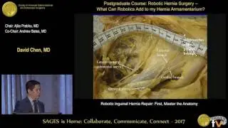 Robotic inguinal hernia repair: First, master the anatomy