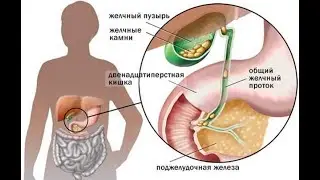 Отзыв о тюбаже